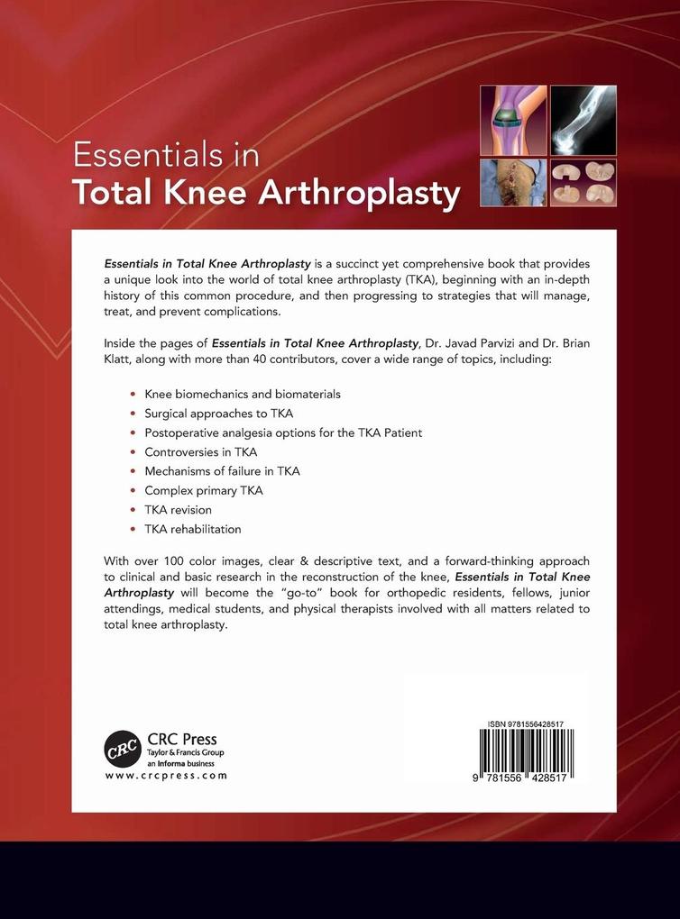 Weitere Ansicht: Essentials in Total Knee Arthroplasty | Javad Parvizi, Brian Klatt