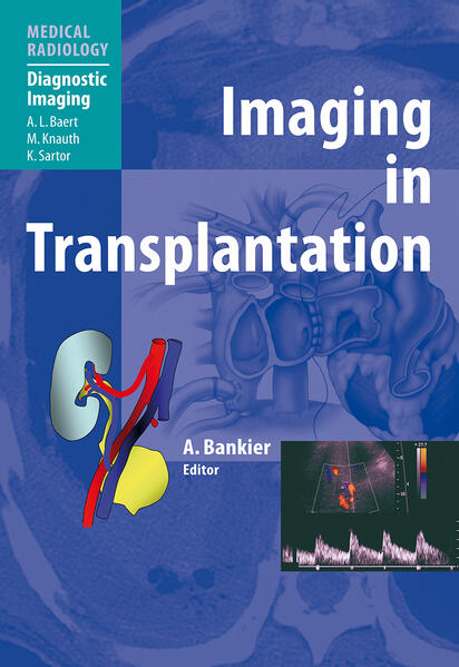 Produktbild: Imaging in Transplantation | A.L. Baert