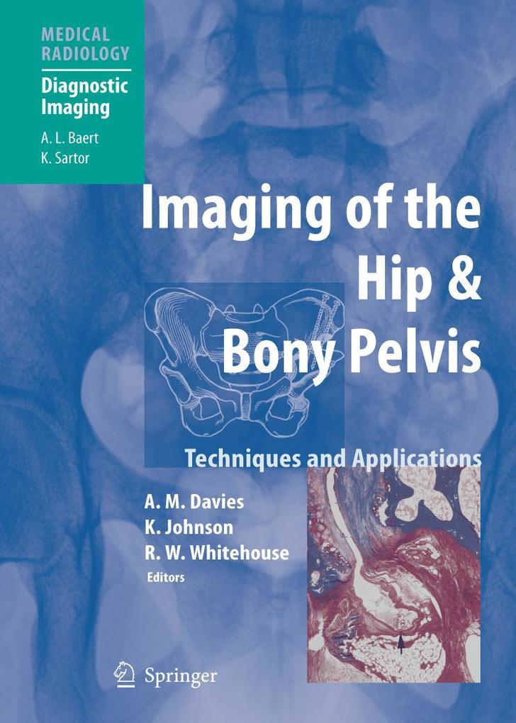 Produktbild: Imaging of the Hip & Bony Pelvis | A.L. Baert