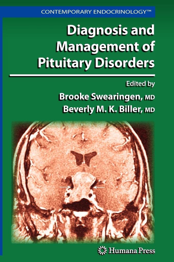 Produktbild: Diagnosis and Management of Pituitary Disorders