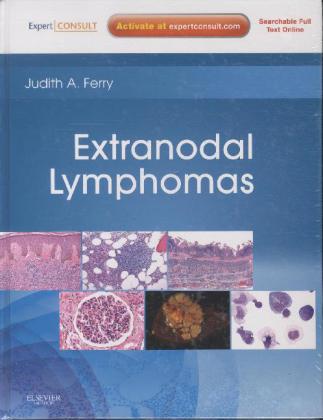 Produktbild: Extranodal Lymphomas | Judith A Ferry