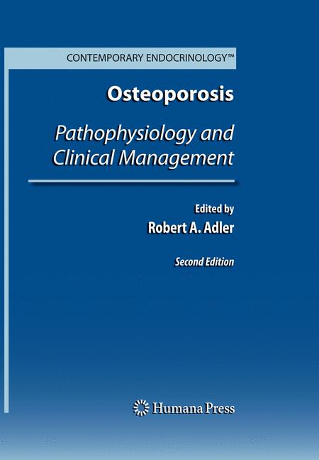Weitere Ansicht: Osteoporosis