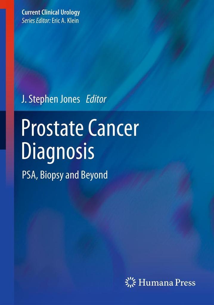 Produktbild: Prostate Cancer Diagnosis