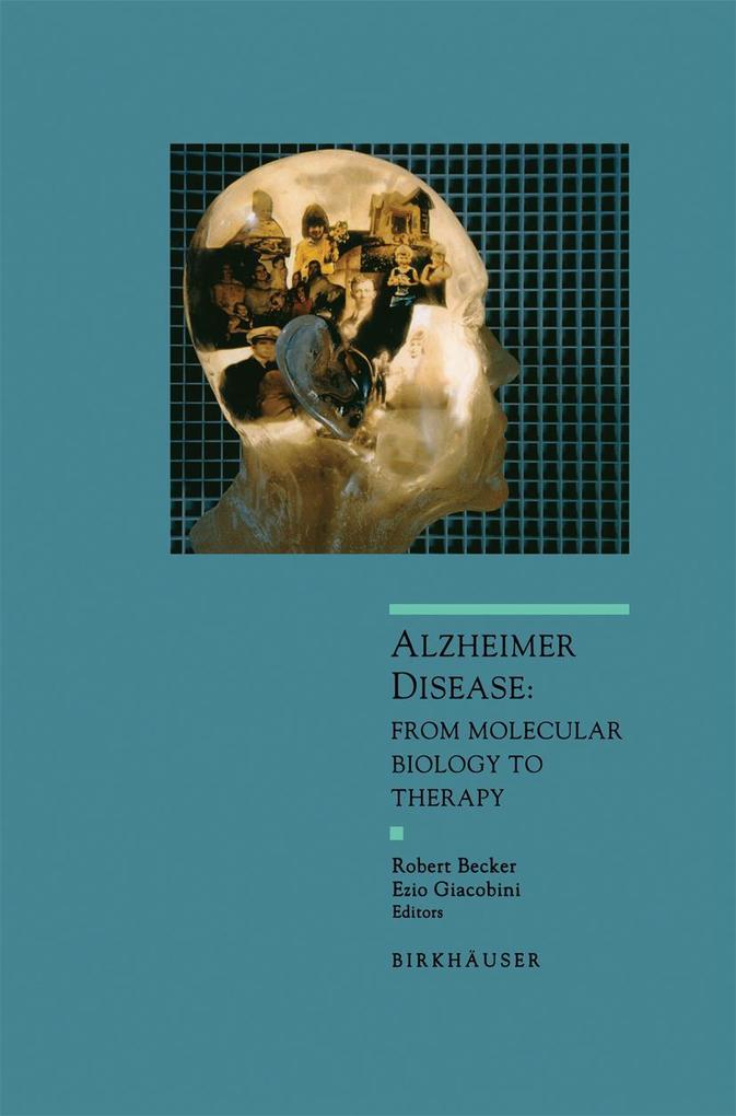 Produktbild: Alzheimer Disease | Robert Becker, Ezio Giacobini