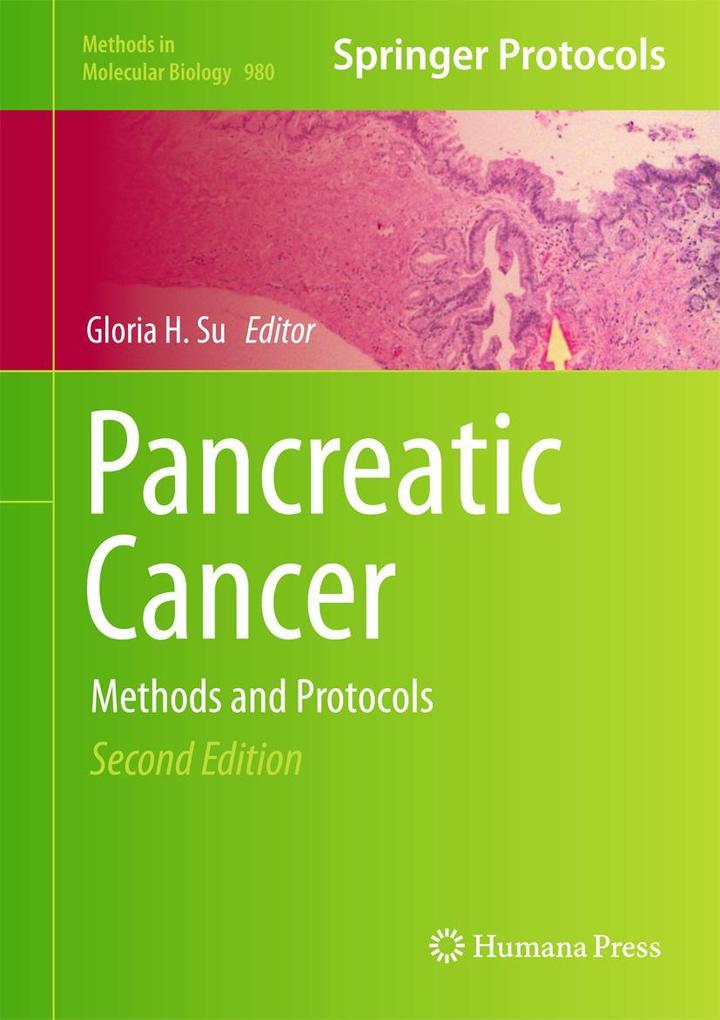 Produktbild: Pancreatic Cancer