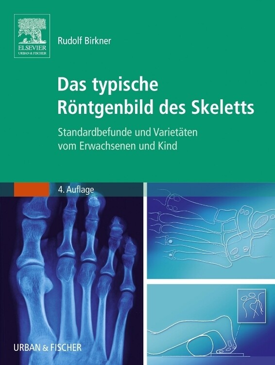 Produktbild: Das typische Röntgenbild des Skeletts | Rudolf Birkner