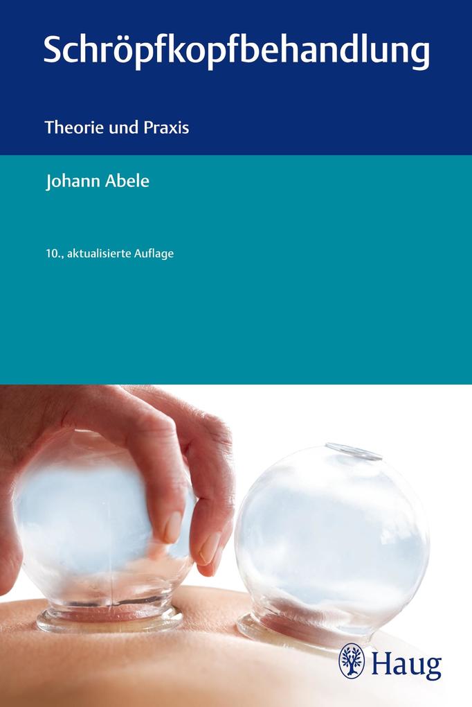 Produktbild: Schröpfkopfbehandlung | Johann Abele