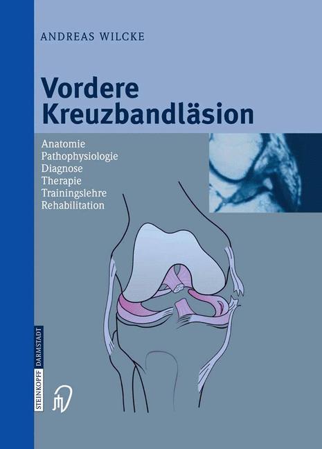 Weitere Ansicht: Vordere Kreuzbandläsion | Andreas Wilcke