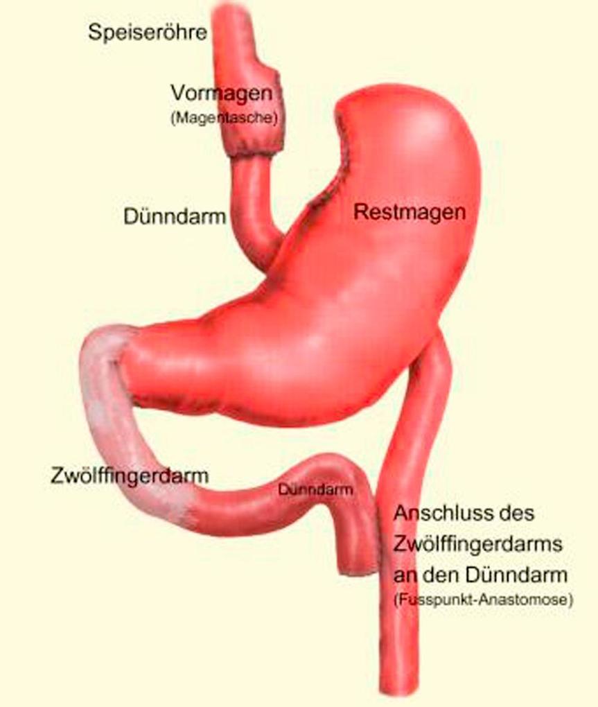 Weitere Ansicht: Endlich dünn! | Benjamin Paul Iddings
