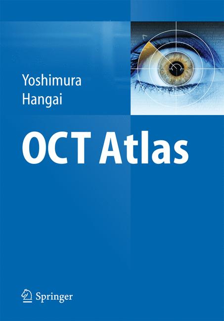 Weitere Ansicht: OCT Atlas | Nagahisa Yoshimura, Masanori Hangai