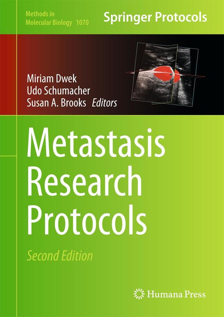 Produktbild: Metastasis Research Protocols