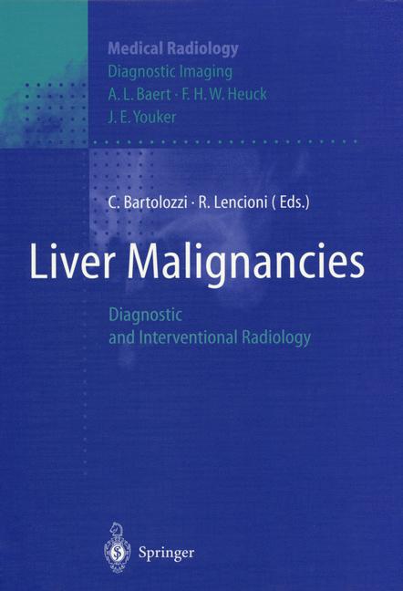 Weitere Ansicht: Liver Malignancies | A.L. Baert