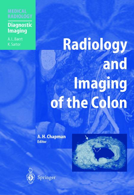 Weitere Ansicht: Radiology and Imaging of the Colon