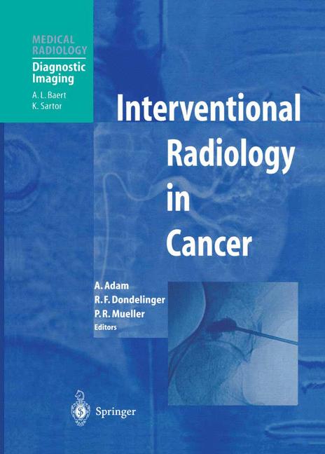 Weitere Ansicht: Interventional Radiology in Cancer