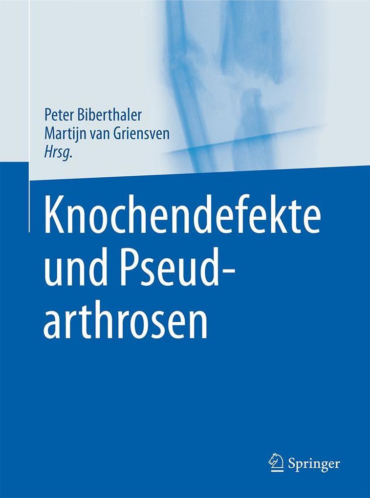 Produktbild: Knochendefekte und Pseudarthrosen
