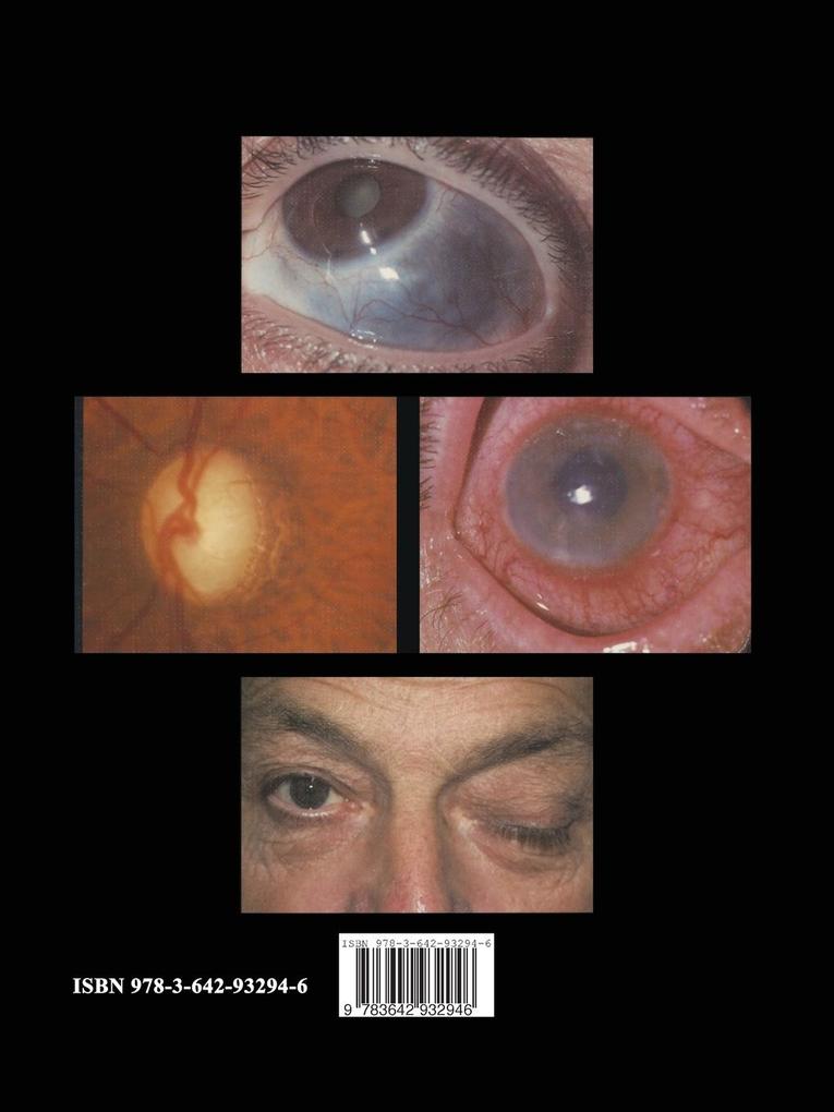 Weitere Ansicht: Auge und Allgemeinerkrankungen | Erna E. Kritzinger, Barry E. Wright