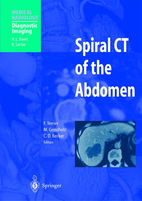 Weitere Ansicht: Spiral CT of the Abdomen | A.L. Baert
