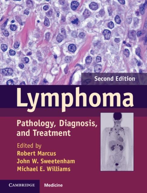 Lymphoma als eBook pdf