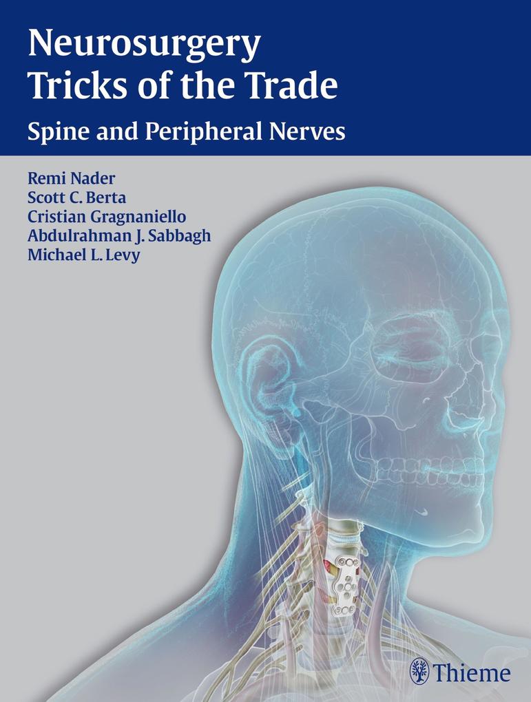 Produktbild: Neurosurgery Tricks of the Trade