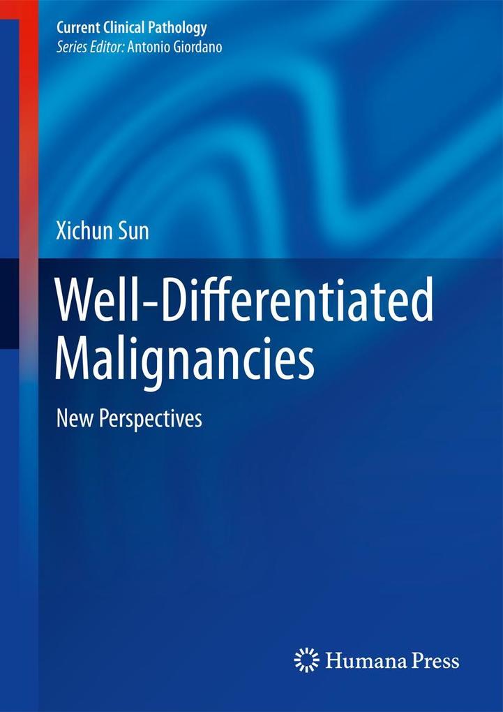 Produktbild: Well-Differentiated Malignancies | Xichun Sun