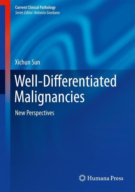 Weitere Ansicht: Well-Differentiated Malignancies | Xichun Sun