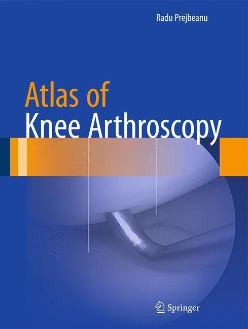 Weitere Ansicht: Atlas of Knee Arthroscopy