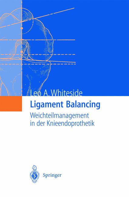 Weitere Ansicht: Ligament Balancing | Leo A. Whiteside