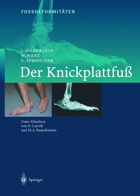 Weitere Ansicht: FussdeformitÄten | L. Döderlein, U. Schneider, W. Wenz