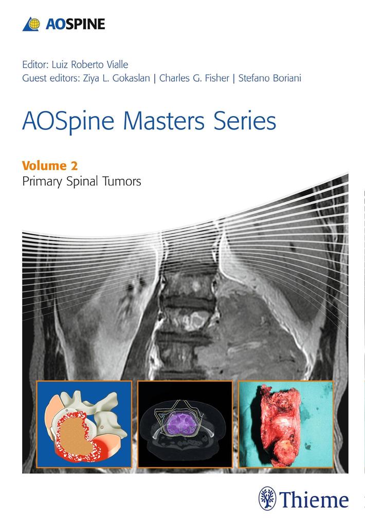 Produktbild: AOSpine Masters Series, Volume 2: Primary Spinal Tumors