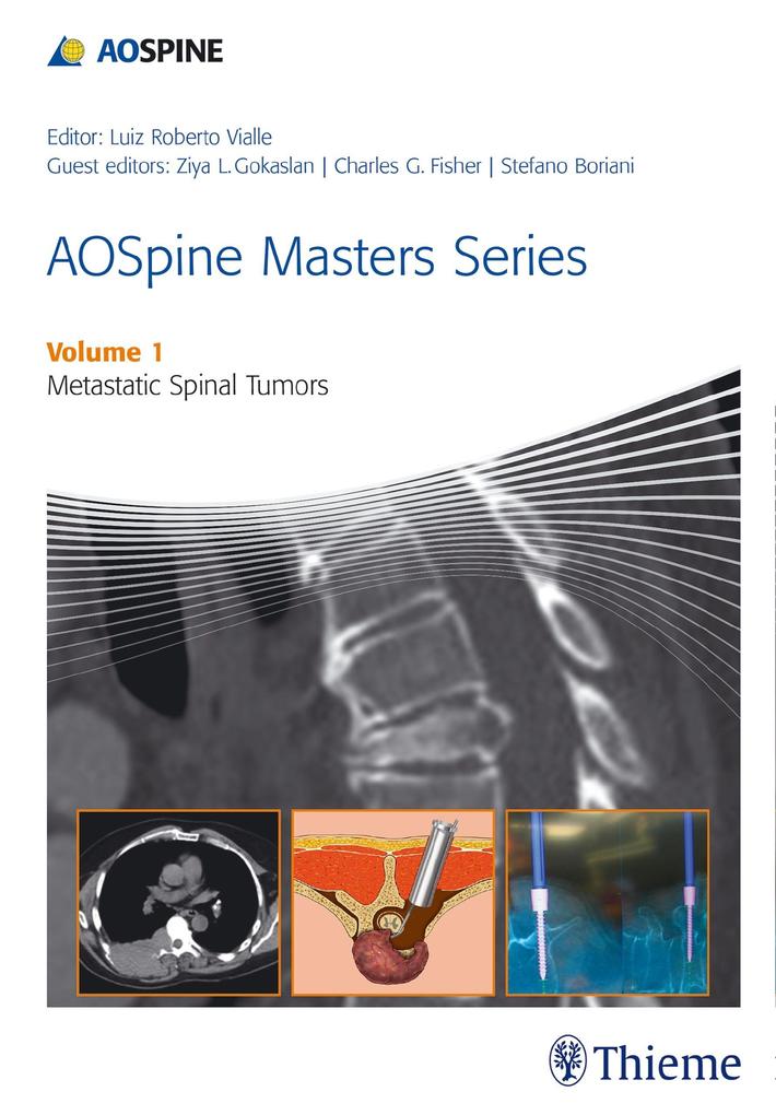 Produktbild: AOSpine Masters Series, Volume 1: Metastatic Spinal Tumors