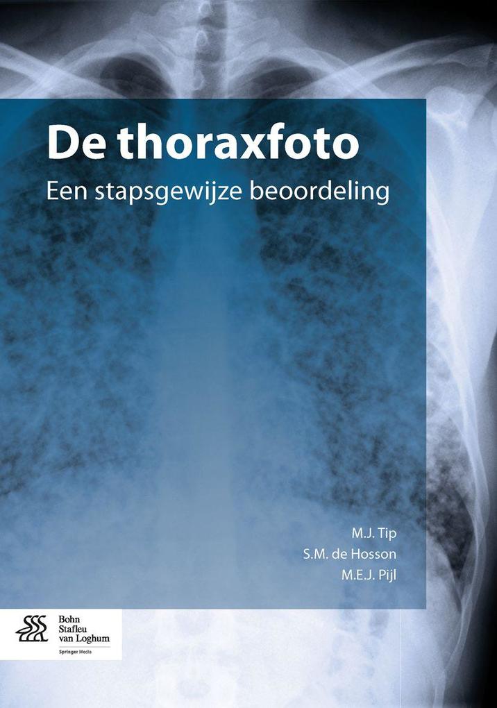 Produktbild: de Thoraxfoto