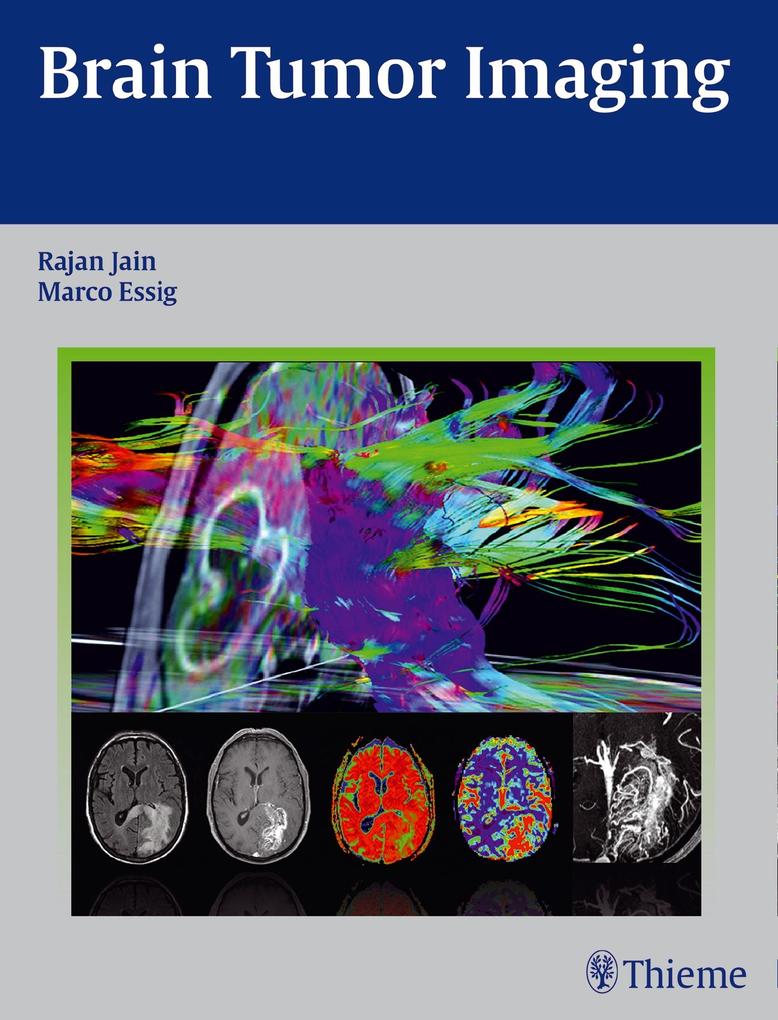 Produktbild: Brain Tumor Imaging | Rajan Jain, Marco Essig