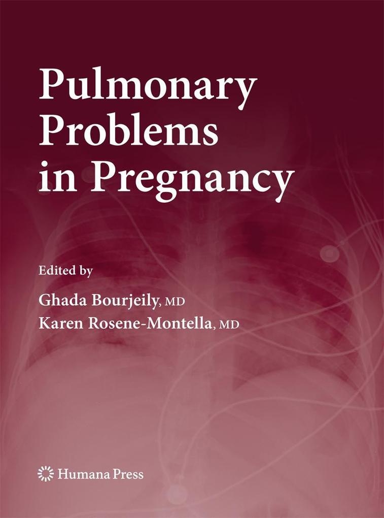 Produktbild: Pulmonary Problems in Pregnancy