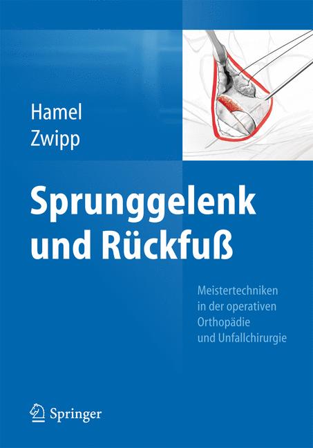 Weitere Ansicht: Sprunggelenk und Rückfuß