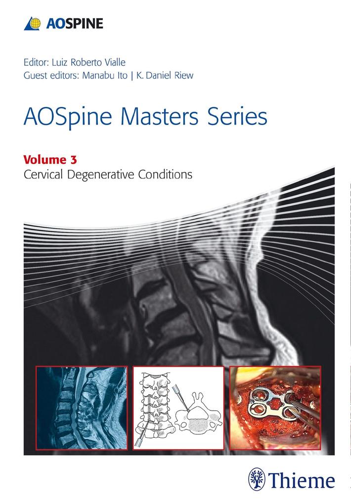 Produktbild: AOSpine Masters Series, Volume 3: Cervical Degenerative Conditions