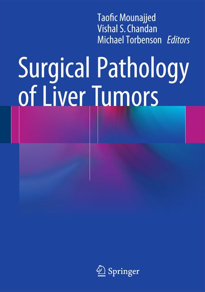 Produktbild: Surgical Pathology of Liver Tumors