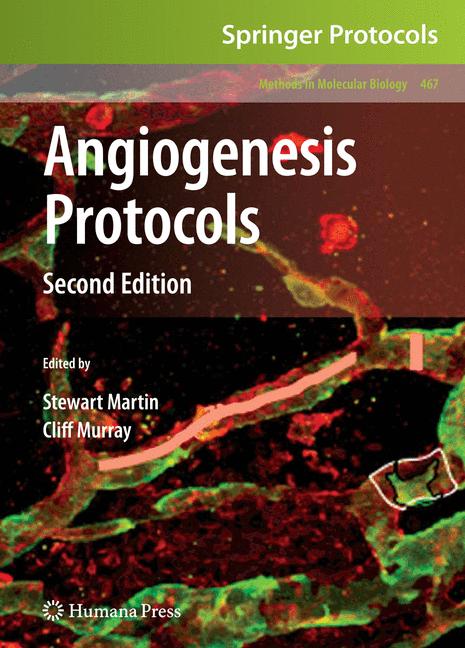 Weitere Ansicht: Angiogenesis Protocols