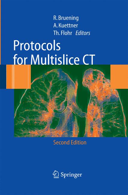 Weitere Ansicht: Protocols for Multislice CT