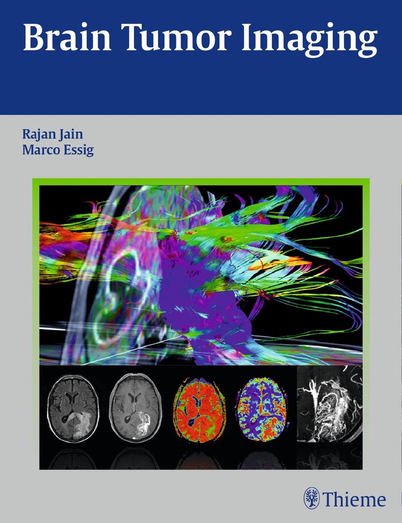 Produktbild: Brain Tumor Imaging | Rajan Jain, Marco Essig