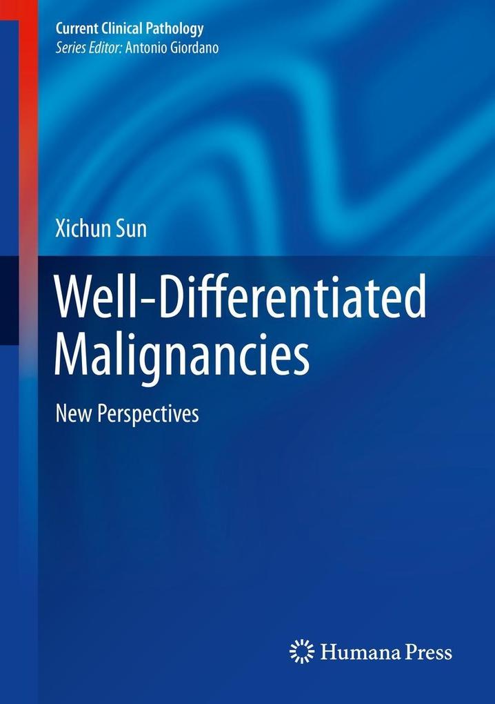 Produktbild: Well-Differentiated Malignancies | Xichun Sun