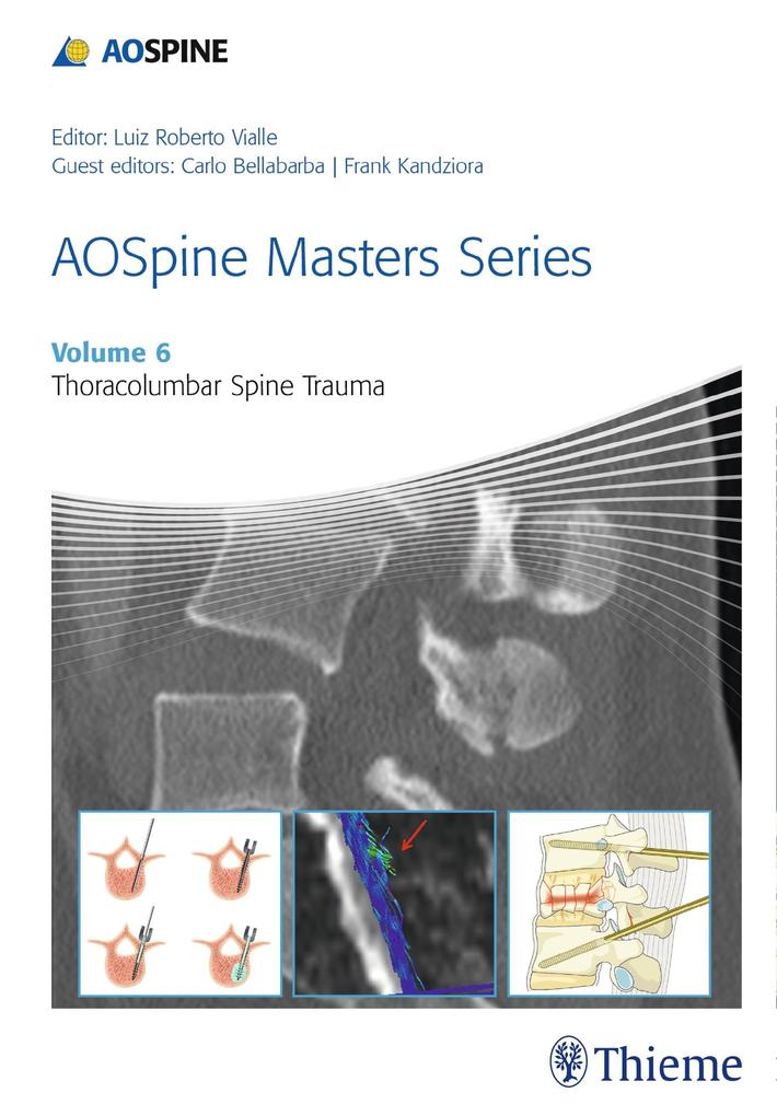Produktbild: AOSpine Masters Series, Volume 6: Thoracolumbar Spine Trauma