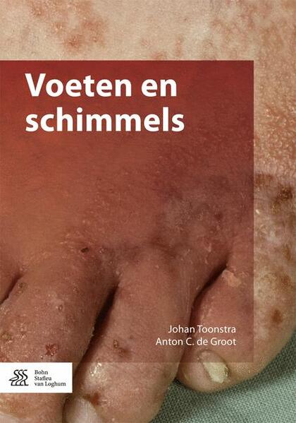 Produktbild: Voeten En Schimmels | Johan Toonstra, A.C. de Groot