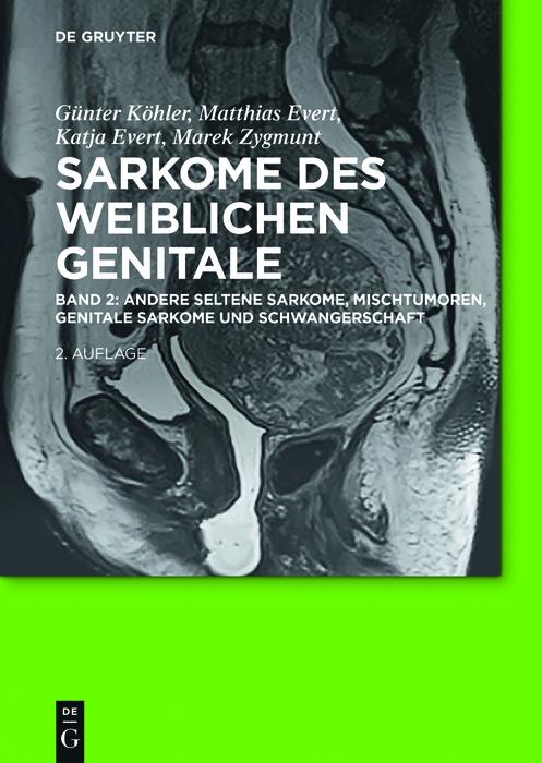 Andere seltene Sarkome, Mischtumoren, genitale Sarkome und Schwangerschaft als eBook epub