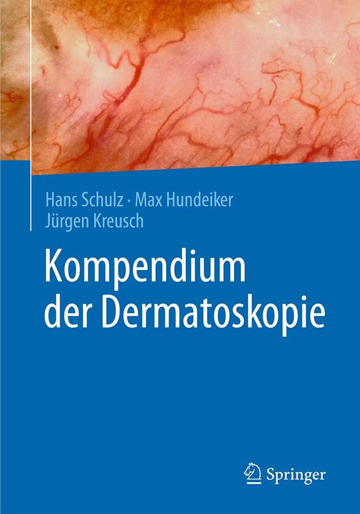Produktbild: Kompendium der Dermatoskopie | Hans Schulz, Max Hundeiker, Jürgen Kreusch