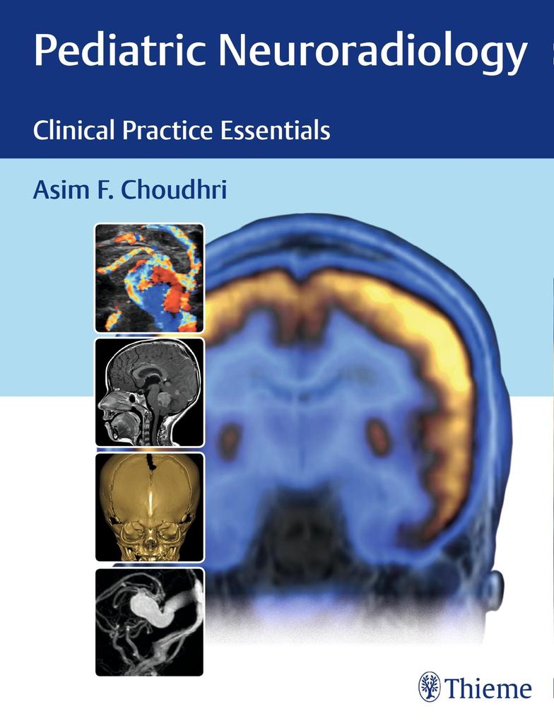Produktbild: Pediatric Neuroradiology | Asim F. Choudhri