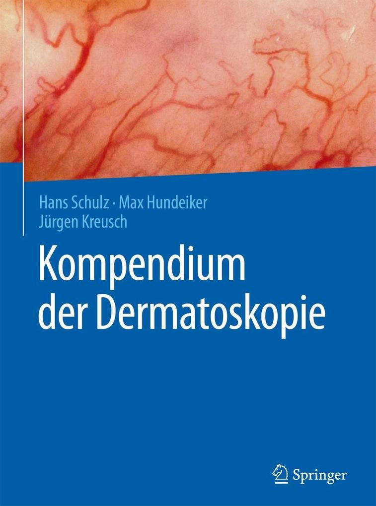 Produktbild: Kompendium der Dermatoskopie | Hans Schulz, Max Hundeiker, Jürgen Kreusch
