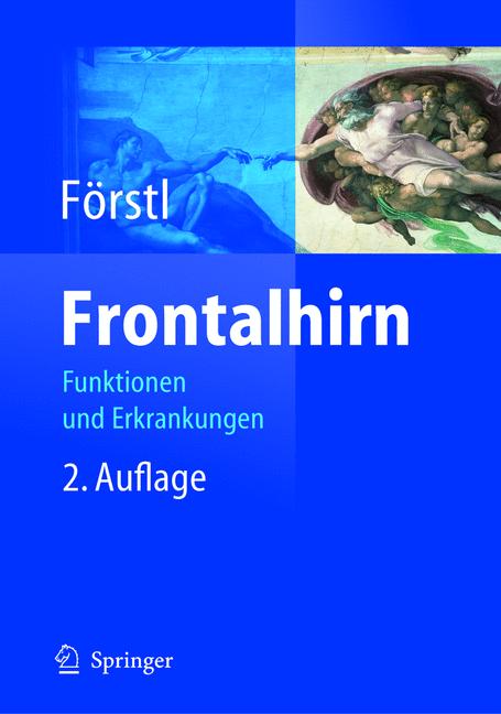 Weitere Ansicht: Frontalhirn