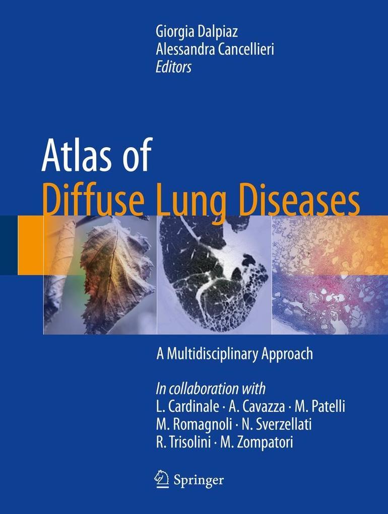 Produktbild: Atlas of Diffuse Lung Diseases