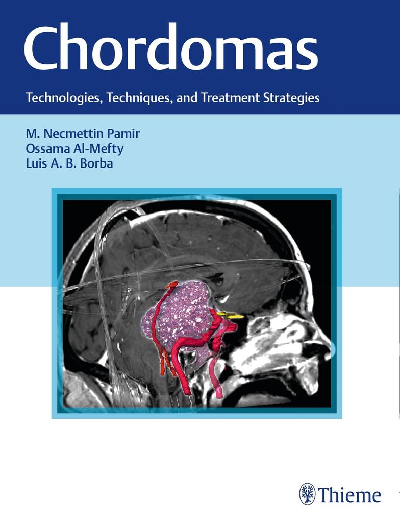 Produktbild: Chordomas