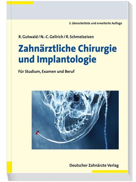 Produktbild: Zahnärztliche Chirurgie und Implantologie | Ralf Gutwald, N. -C. Gellrich, Rainer Schmelzeisen